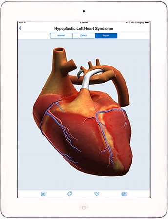 Heartpedia Mobile App.